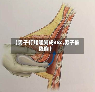 【男子打赌隆胸成38c,男子被隆胸】-第2张图片
